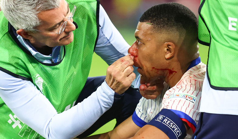 Foto: Spokój wokół Mbappé