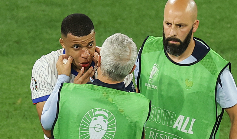Foto: Oficjalnie: Mbappé bez operacji i ze specjalną maską do gry