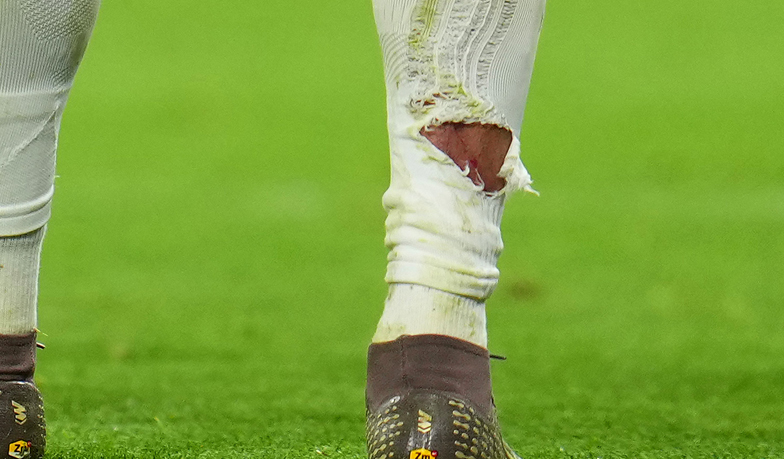 GŁOS KIBICA: Tah na Mbappé / Carreras na Olise [VIDEO]