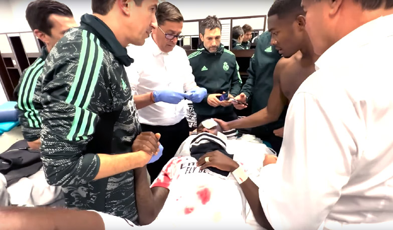 Foto: Szycie czoła Rüdigera na stadionie Legii [VIDEO]