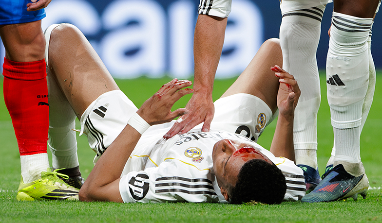 GŁOS KIBICA: Łokieć na twarzy Mbappé